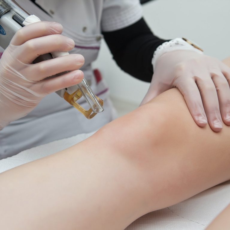 Benefits of shockwave therapy 