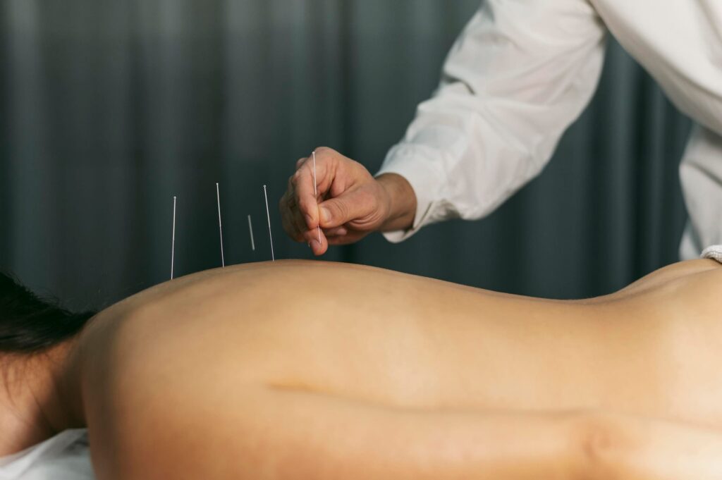 Acupuncturist