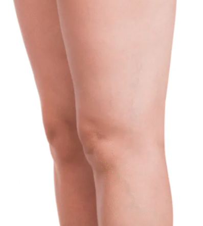 Skin after Hydrafacial treatment