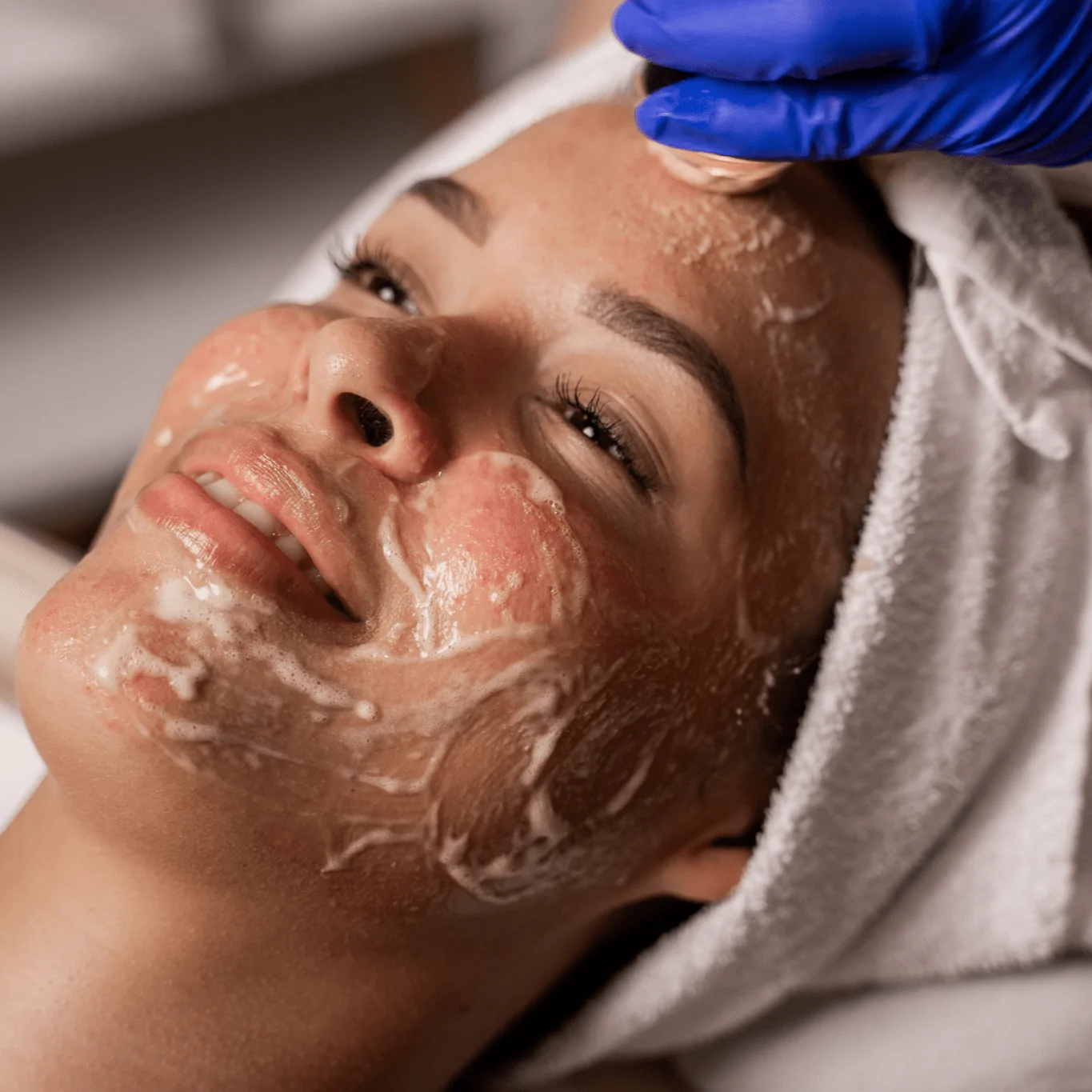 Laser skin treatment services