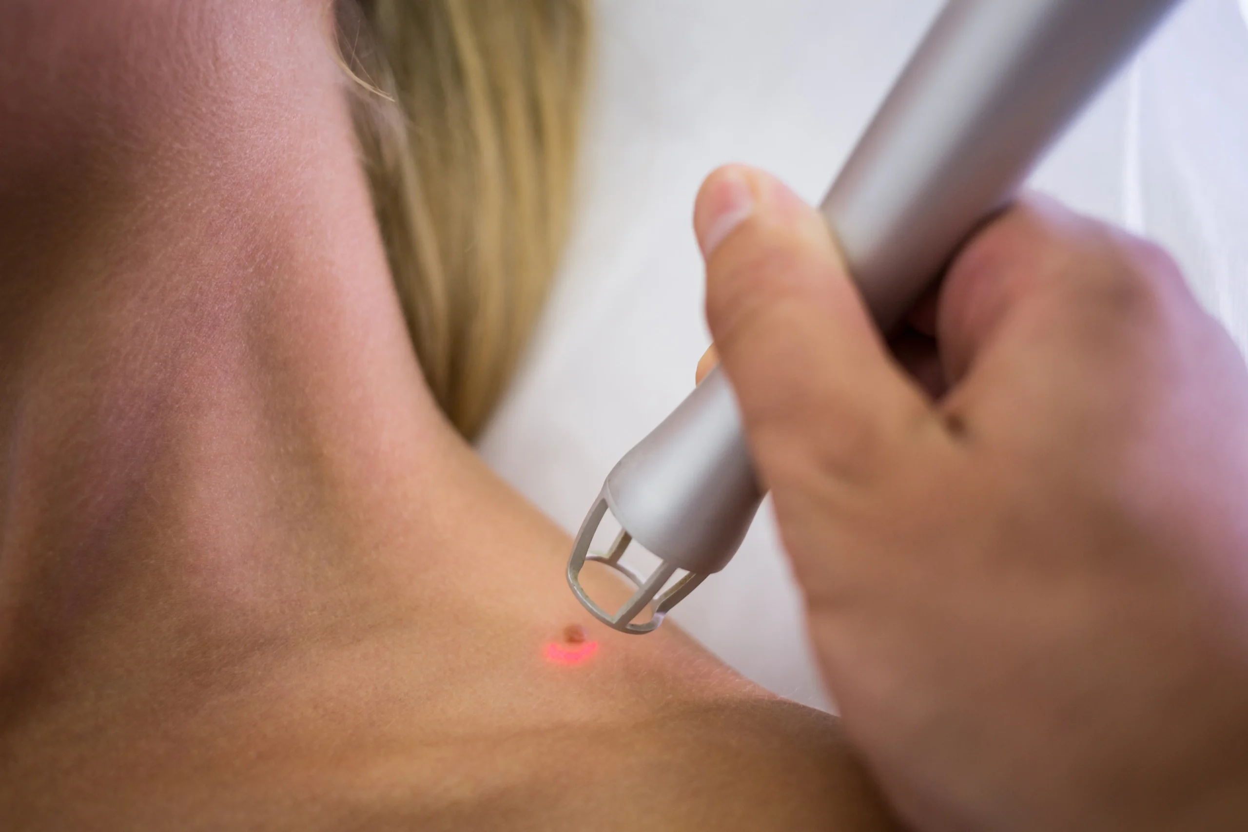 Laser Therapy