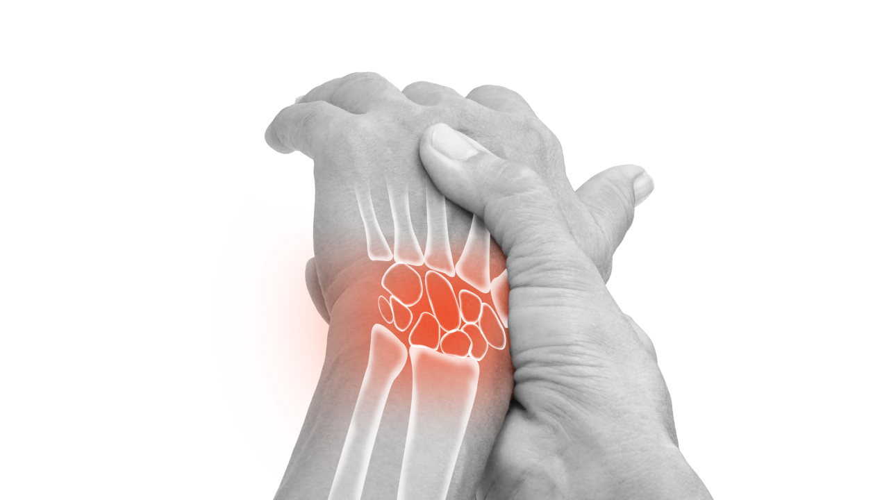 Physiotherapy for Arthritis
