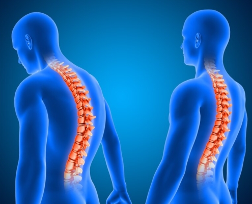 Exploring the Benefits of Chiropractic Care: A Comprehensive Overview