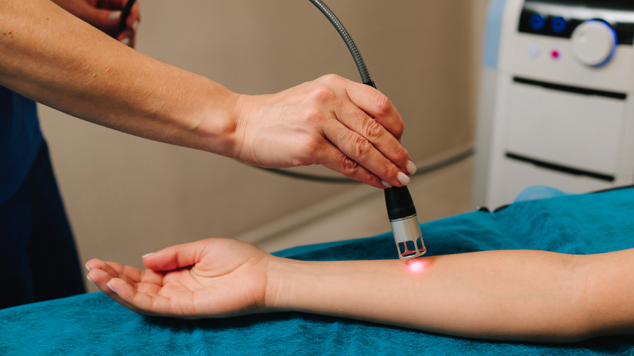 Cold Laser Therapy