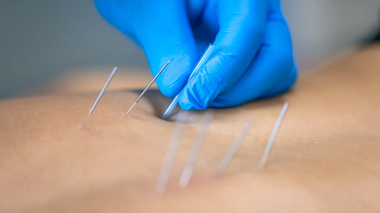 Physiotherapist providing treatment for neck pain