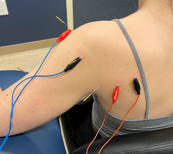 Physiotherapist providing treatment for neck pain