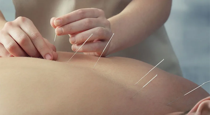 Orthopedic Physiotherapy